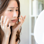 敏感肌による頬の赤みを気にする女性が鏡を見ている様子