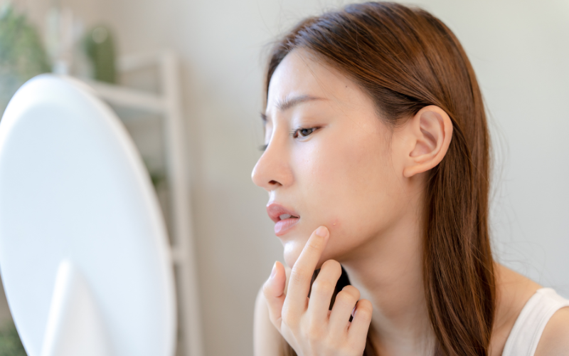 敏感肌による頬の赤みを気にする女性が鏡を見ている様子