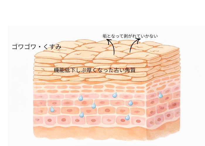 乾燥によって角質が厚くなり、水分が行き渡りにくくなった肌の断面図