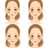 シミの種類（老人性色素斑・肝斑・そばかす・炎症後色素沈着）の比較イラスト