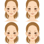 シミの種類（老人性色素斑・肝斑・そばかす・炎症後色素沈着）の比較イラスト